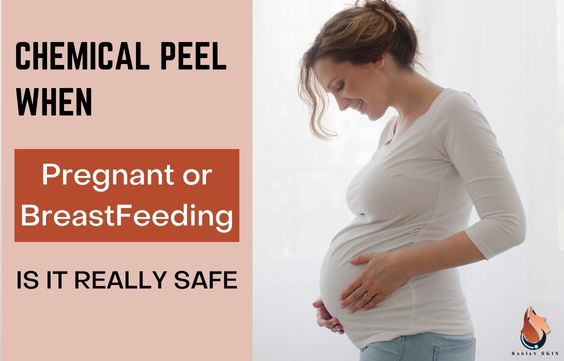 Can You Get a Chemical Peel When Pregnant or Breastfeeding