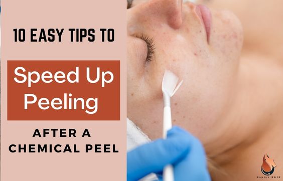 10 Tips to Speed Up Peeling After a Chemical Peel