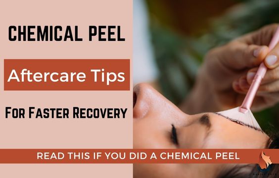 Chemical Peel AfterCare Tips To Heal Fast & Common FAQ