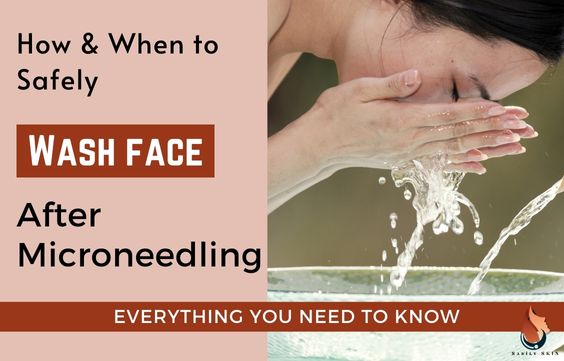 How & When to Safely Wash Face after Microneedling