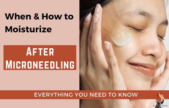 When & How to Moisturize After Microneedling & What to Use 