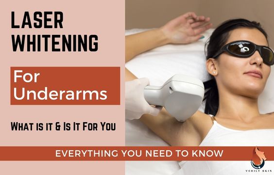 Laser Whitening for Underarms: Cost, Risks, How Fast is it