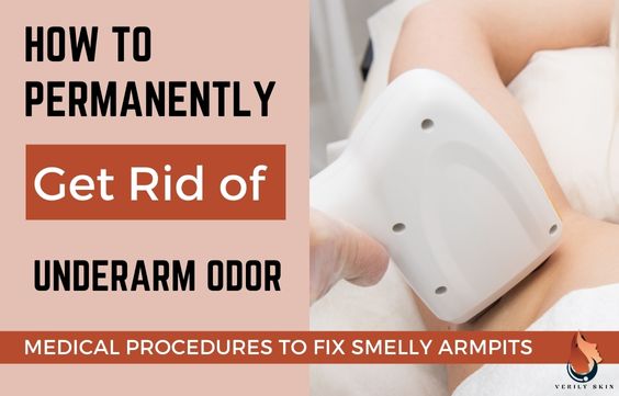 How to Get Rid of Underarm Odor & Sweating Permanently