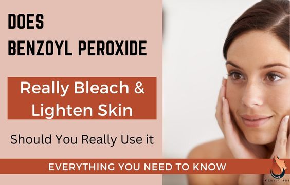 Does Benzoyl Peroxide Bleach & Lighten Skin: Actual Truth 