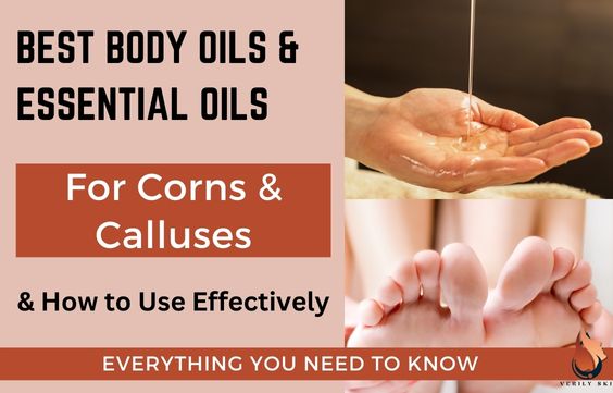 Best Essential Oils & Body Oils to Treat Corns & Calluses