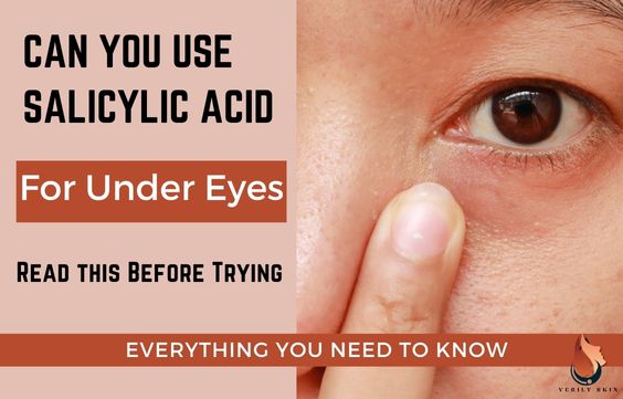 Can you use Salicylic Acid Under the Eyes - Shocking Truth