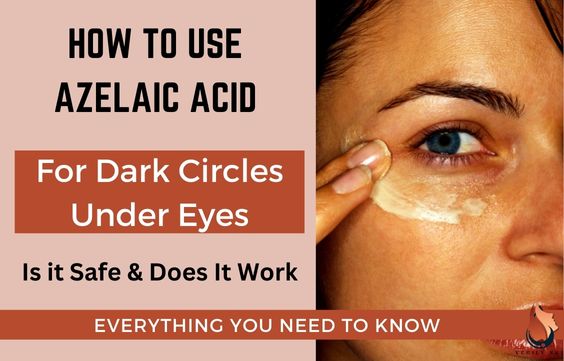 Using Azelaic Acid for Wrinkles & Circles Under the Eyes