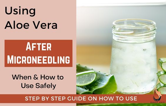 Aloe Vera after Microneedling & Dermarolling - Is it Safe
