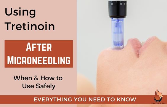 Tretinoin After Microneedling - When & How to Use