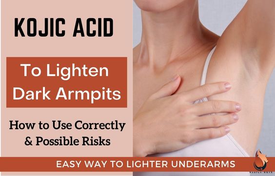 Kojic Acid for Dark Underarms- How to Use Correctly & Risks