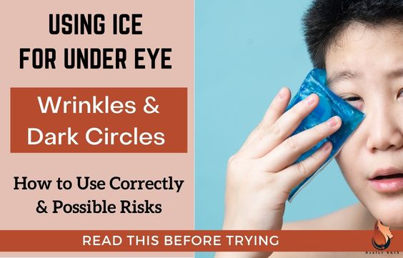 Using Ice For Under-Eye Circles: Is it Safe, Pros & Cons 