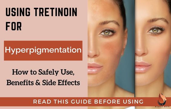 Tretinoin for Hyperpigmentation How To Use & Is it Good
