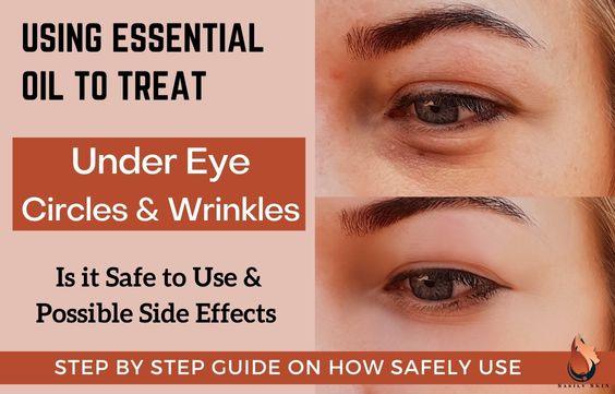 Using Essential Oils For Under-Eyes - Puffy Circles & Wrinkles 