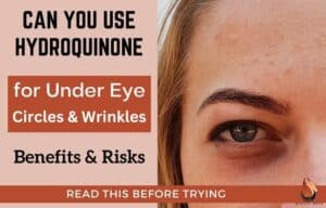 Can You Use Hydroquinone for Under-Eye Circles & Wrinkles - Sasily Skin