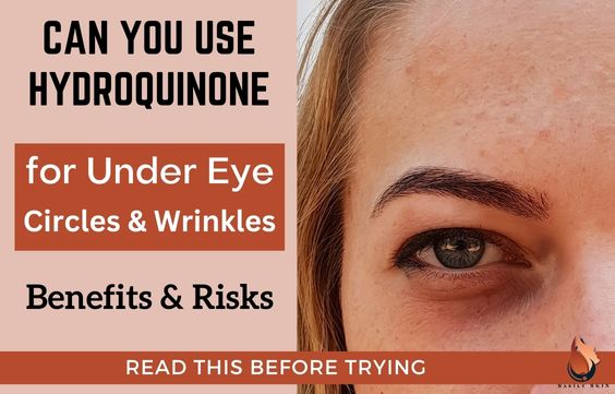 Can You Use Hydroquinone for Under-Eye Circles & Wrinkles 