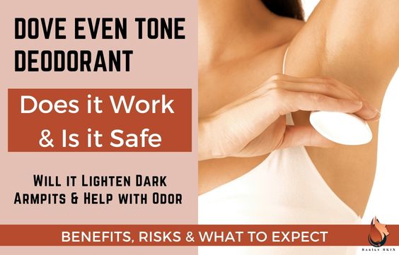 Dove Even Tone Deodorant Review- Does It Work & Is It Safe