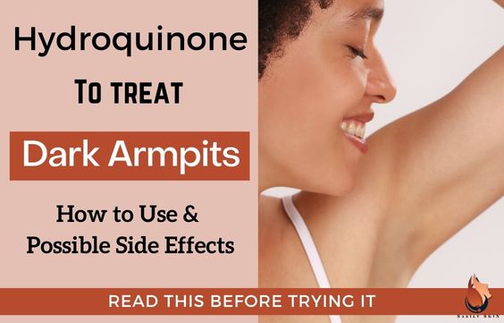 Hydroquinone For Dark Underarms - How to Use & Side Effects