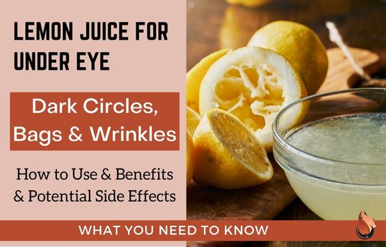 Lemon Juice for Under-Eye Circles & Wrinkles - Benefits & Risks