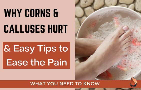 Why Do Corns & Calluses Hurt & Easy Tips to Ease the Pain