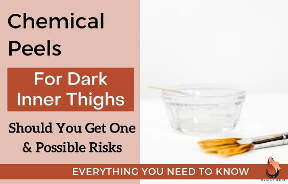 Chemical Peels for Dark Inner Thighs - Is it Safe & Risks