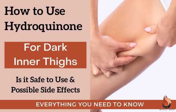 Hydroquinone for Dark Inner Thighs- How to Use & Risks