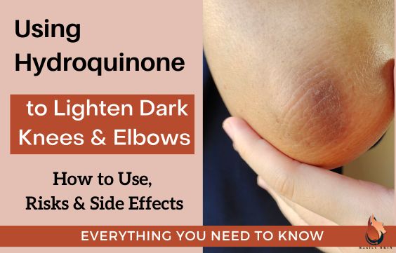 A Guide to Using Hydroquinone for Dark Knees & Elbows