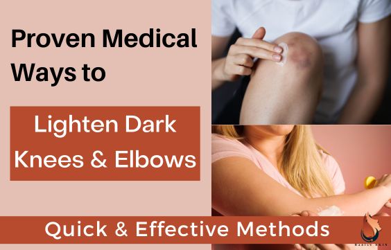 9 Best Medical Ways to Lighten Dark Knees & Elbows
