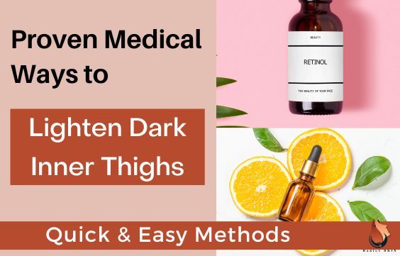 9 Proven Ways How to Lighten Dark Inner Thighs 