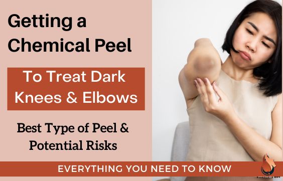 Chemical Peel to Lighten Dark Knees & Elbows